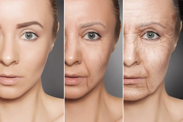最近話題の「糖化」は老化要因の一つで、肌のハリやシワなどにも密接に関係している。写真はイメージ(c)transurfer-123RF